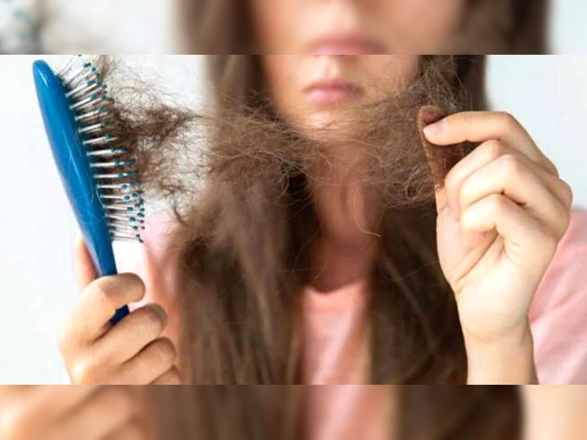 Hair Loss: अगर आपके काले घने बाल छोड़ रहे आपका साथ, तो ऐसे मिलेगा Hair Fall से छुटकारा