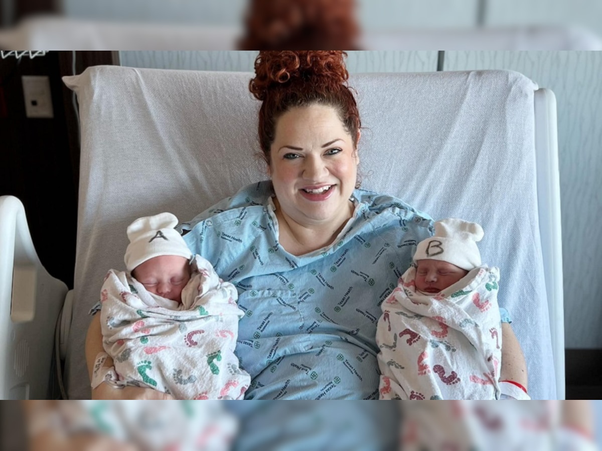 Twins Birth: अजूबा! महिला ने दिया जुड़वा बच्चों को जन्म, लेकिन समय अलग और साल अलग