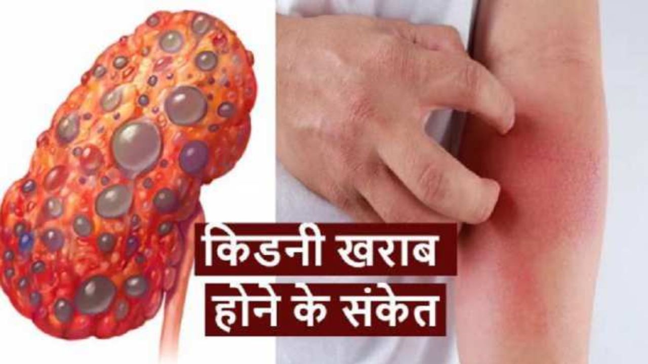What are the signs of kidney disease what are problems in kidney disease what happens due to 