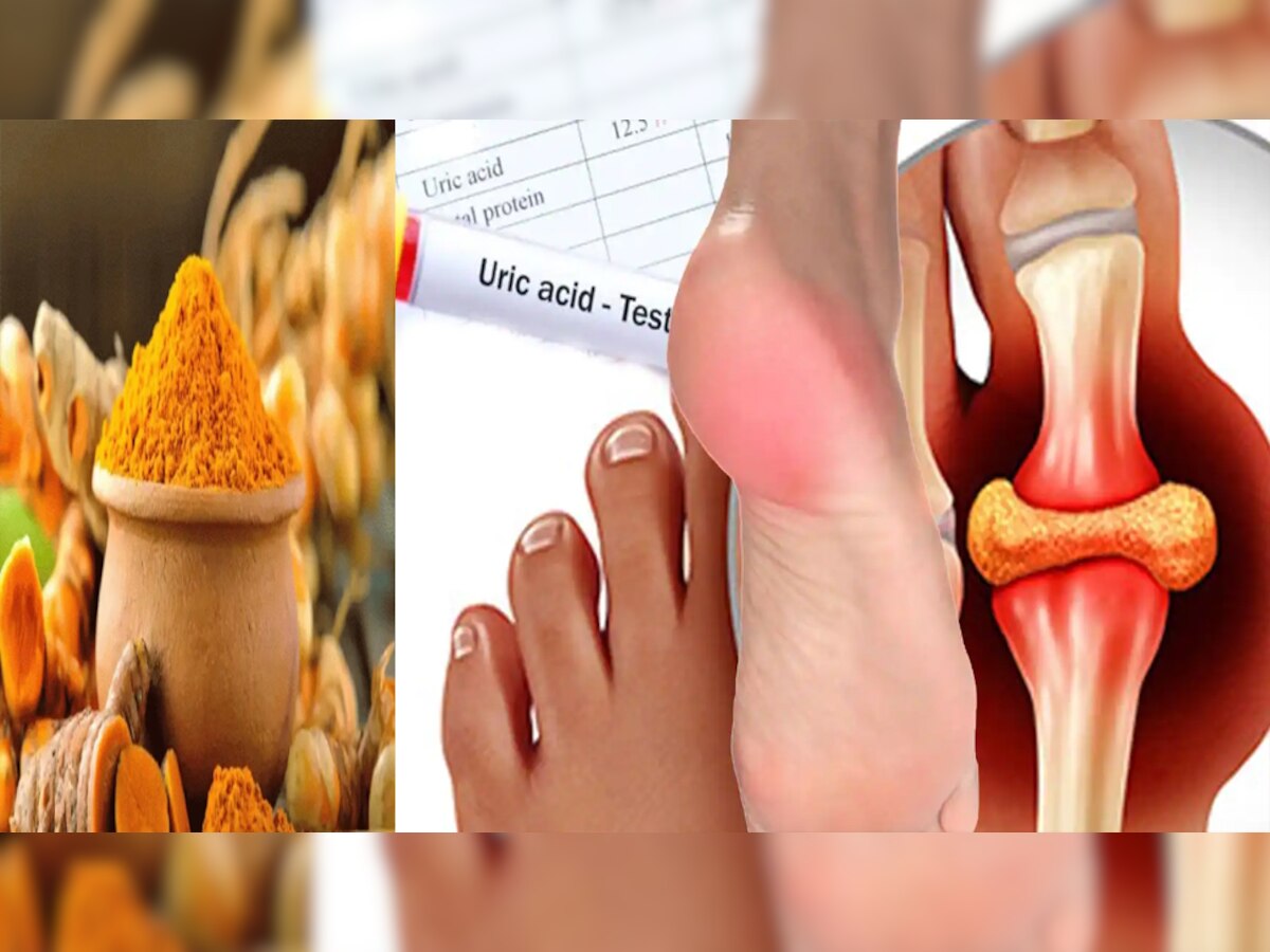 uric acid level reduce Remedies with turmeric high uric acid kam karne