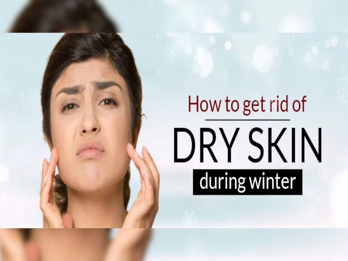 How To Get Rid Of Dry Cheeks: सर्दियों में गाल और त्वचा दिखने लगे हैं फटे-फटे, इन घरेलू नुस्खों की मदद से मिलेगी कोमल त्वचा