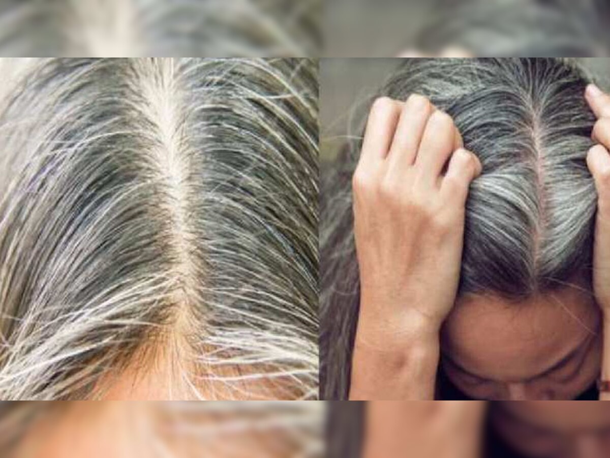 White Hair Home Remedies: सफेद बालों को घर बैठे प्राकृतिक तरीके से ऐसे कीजिए काला, बड़े काम के हैं ये 3 घरेलू उपाय