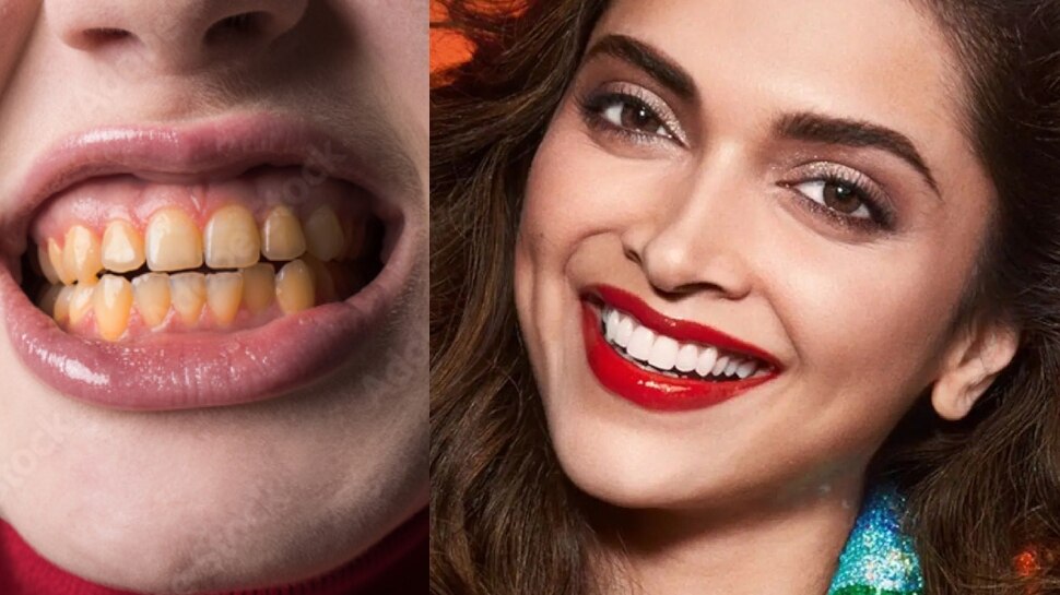 teeth Whitening home remedies yellow teeth problem peele dant Teeth