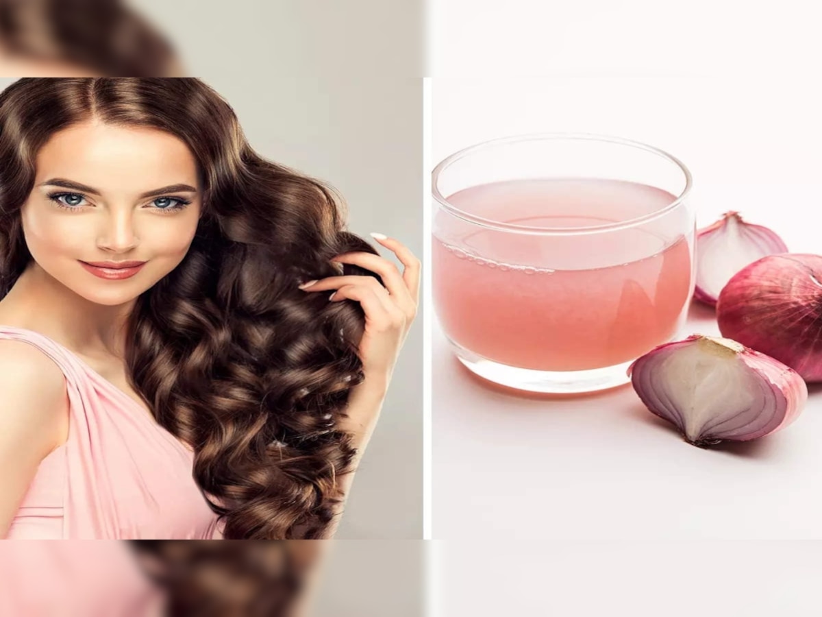 Onion For Hair Growth: Hair Growth के लिए ऐसे लगाएं Onion, बालों की हर समस्या होगी दूर