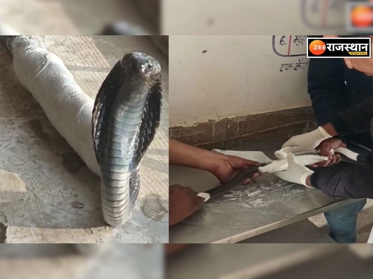 Jaisalmer: जहरीले कोबरे का रीढ़ की हड्डी का हुआ प्लास्टर, डरते डरते सफल हुआ ऑपरेशन