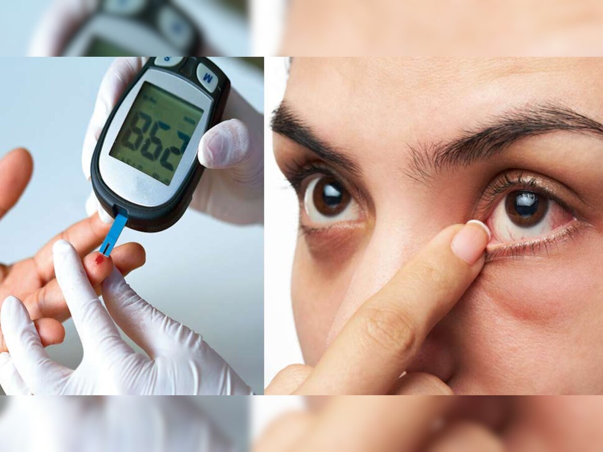 Onion Benefits For Type 2 Diabetes pyaaz khane ke fayde Weight Loss