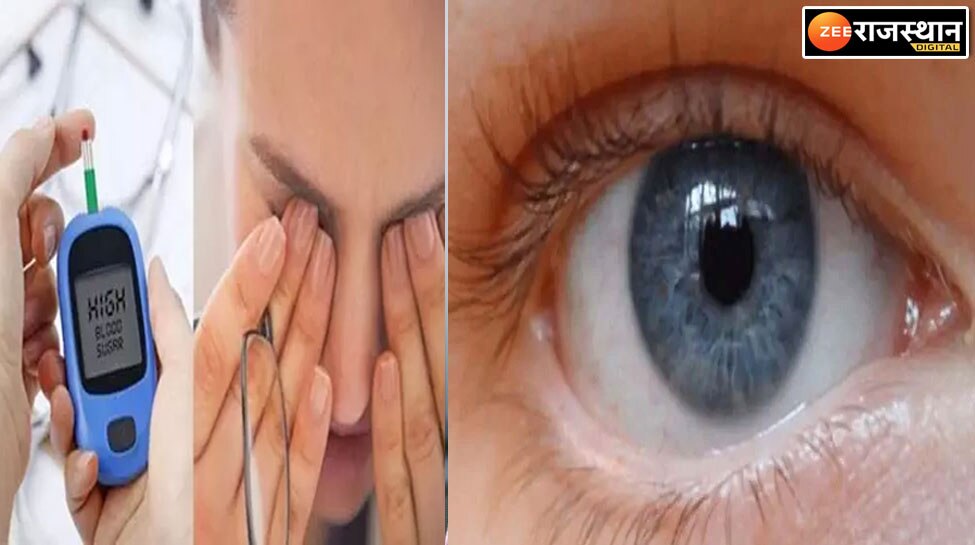 Diabetic Eyes Tips Diabetes patients should take care of their eyes otherwise light may go away