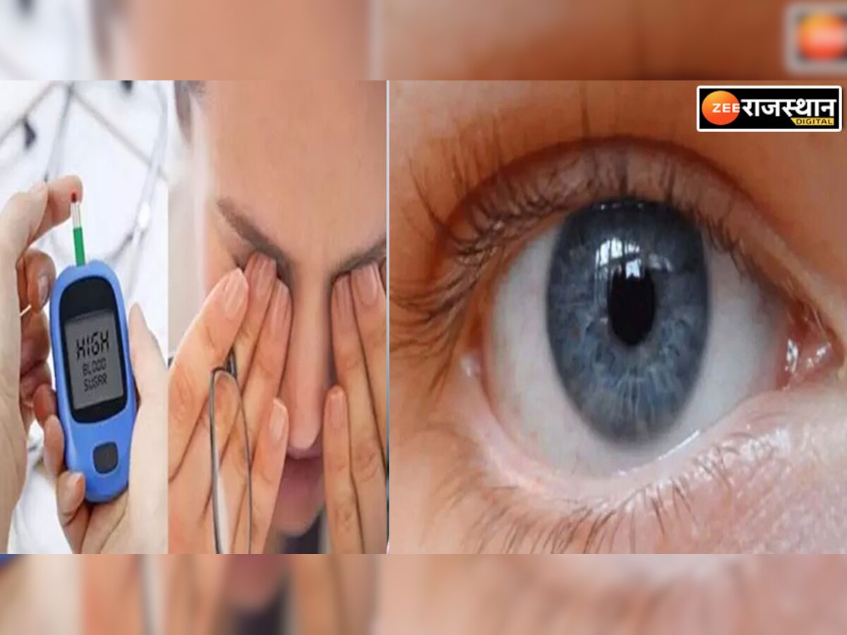 Diabetic Eyes Tips: डायबिटीज के मरीज अपनी आंखों का रखें ख्याल, वरना जा सकती है रोशनी