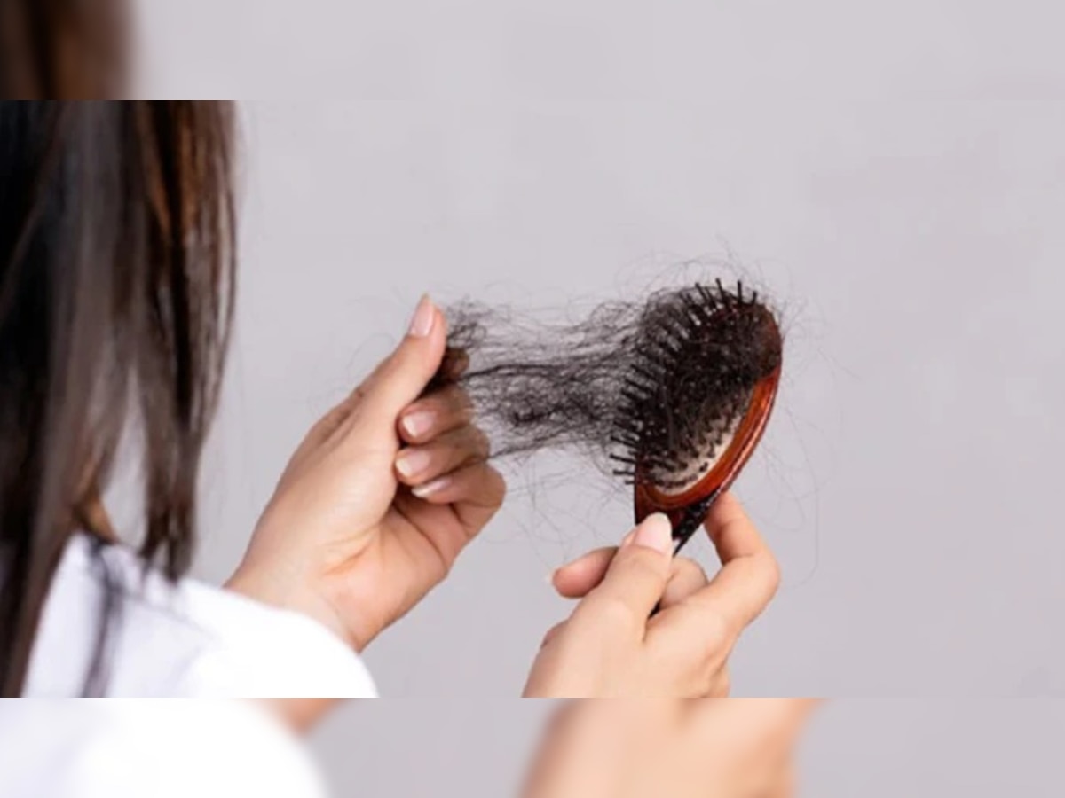 Hair care tips: झड़ते बाल और डैंड्रफ से निजात पाने के लिए अपनाएं ये टिप्स, जल्द होगा benefit  