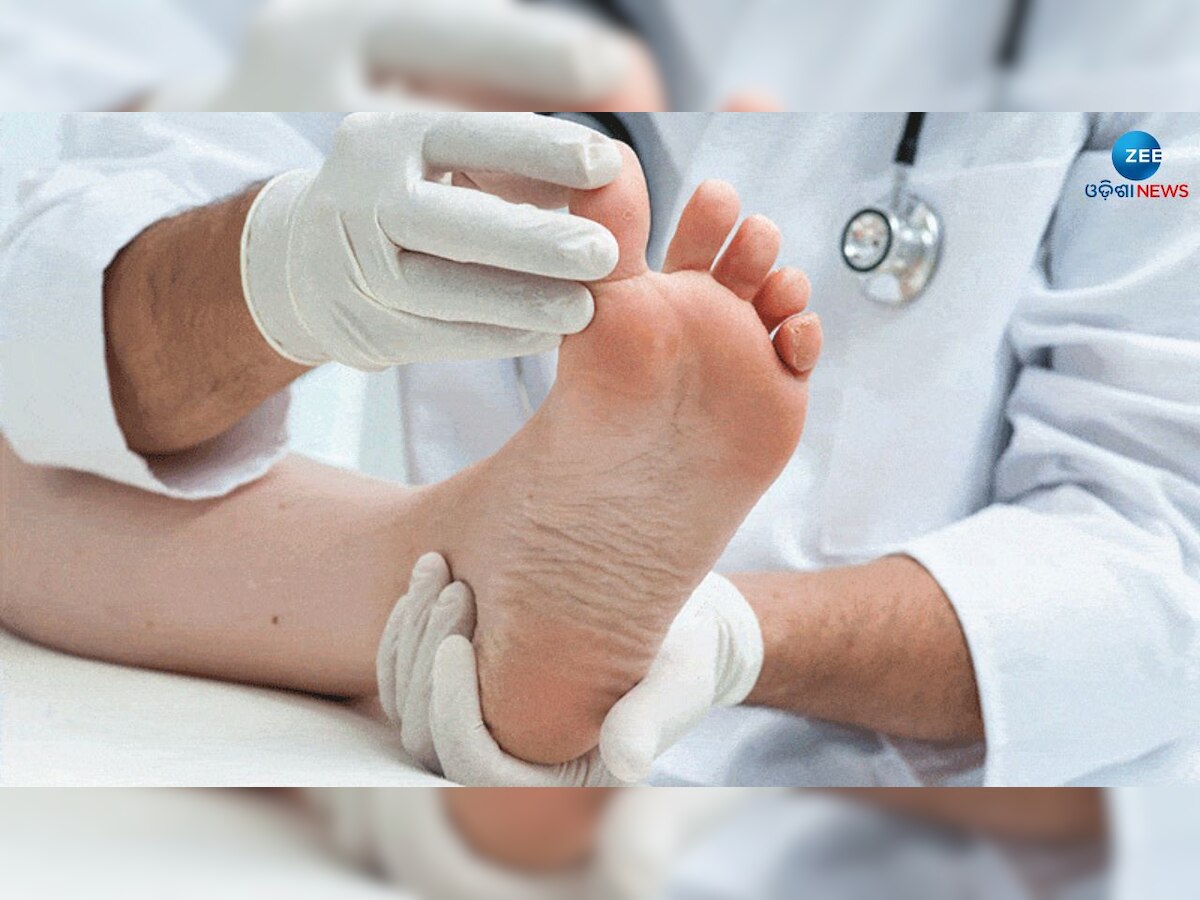 Diabetic Foot Care Tips: ମଧୁମେହ ରୋଗୀମାନେ ରାତିରେ କିଣନ୍ତୁ ଜୋତା ଓ ଚପଲ, ଜାଣନ୍ତୁ ଏହାରି ପଛରେ ରହିଛି କେଉଁ କାରଣ ?