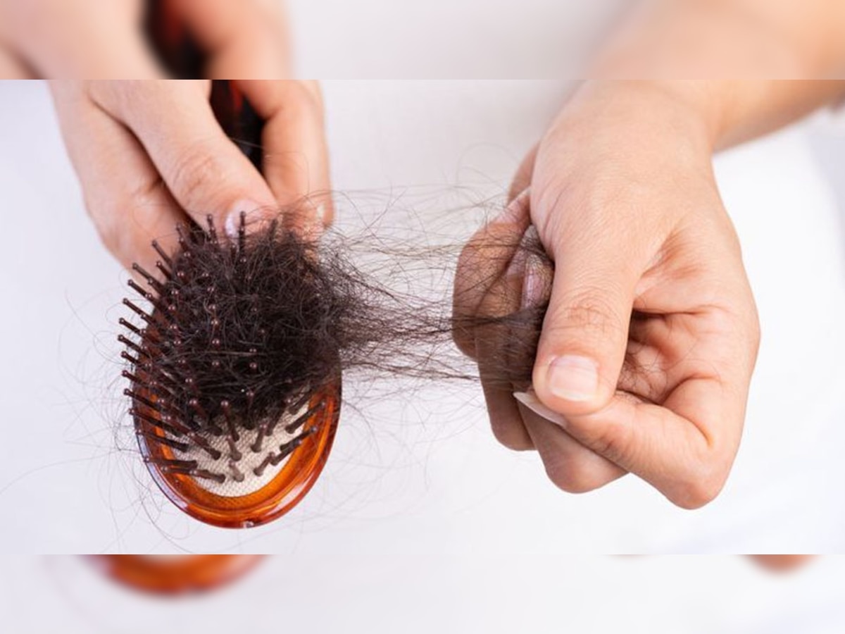 Hair Care Tips: बालों के झड़ने और सफेदी से झेलनी पड़ती है शर्मिंदगी? आजमा लें घर पर बना ये खास तेल, पहले की तरह लहलहा उठेंगे बाल  