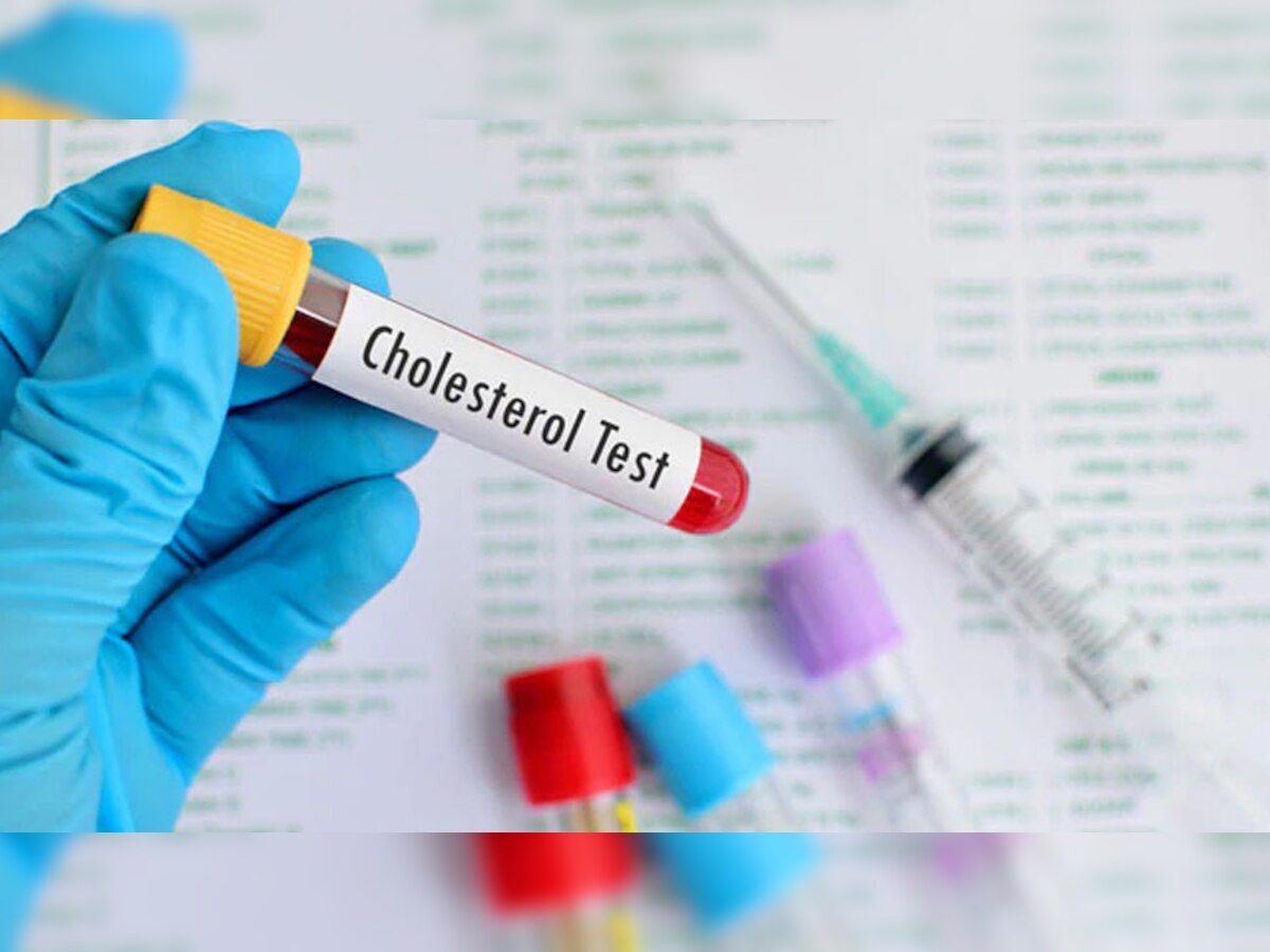 Cholesterol Control Tips: अपनी लाइफस्टाइल में कर लीजिए ये 5 चेंज, बर्फ की तरह पिघलना शुरू हो जाएगा Bad Cholesterol