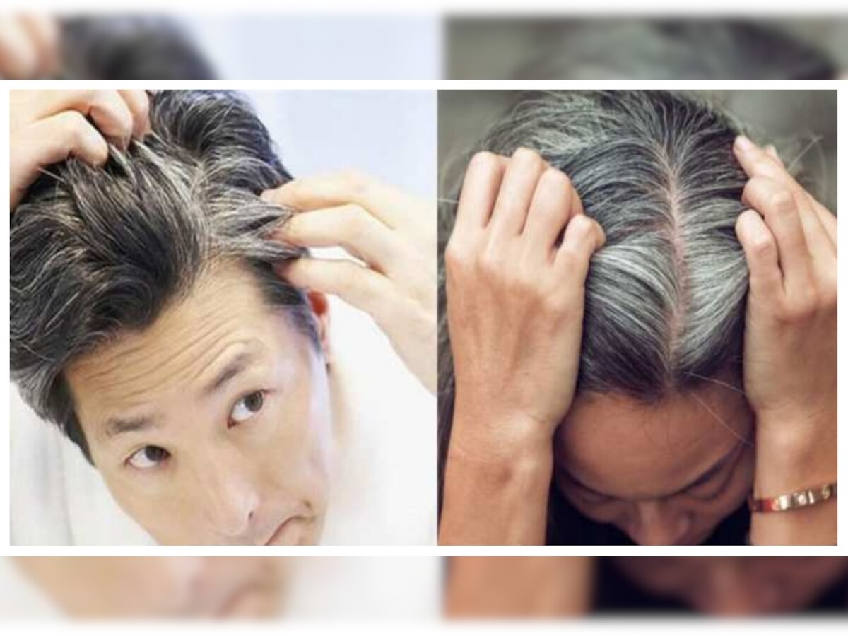 Hair Care Tips: नारियल के तेल में मिलाकर लगाएं ये चीजें, दूर होगी White Hair की दिक्कत