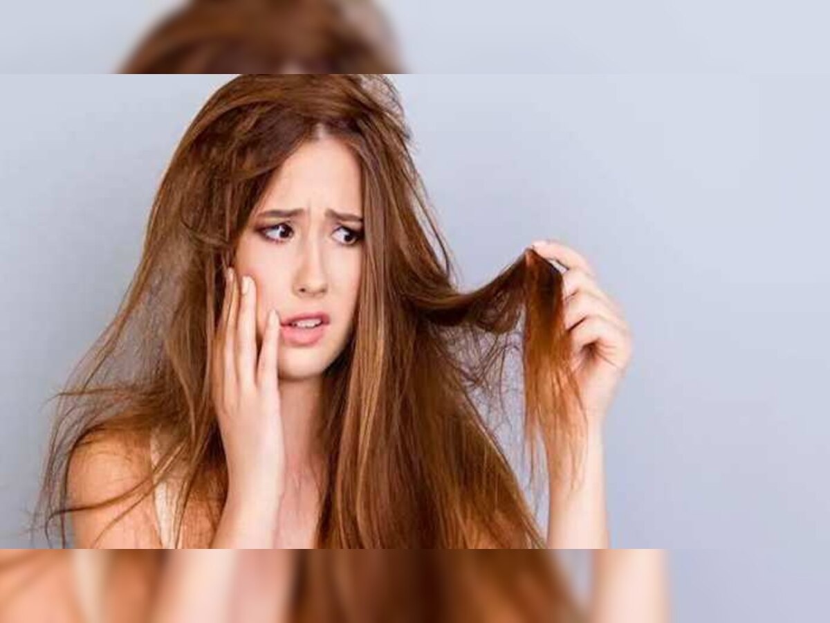 Hair Care Tips: चिपचिपे बालों से हैं परेशान, इन तरीकों से समस्या होगी दूर