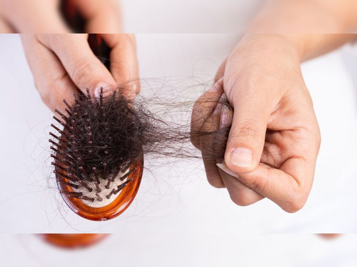 Hair Care Foods: कंघी करते ही हाथ में आ जाता है बालों का गुच्छा? आज से ही खाना शुरू कर दें ये 5 सुपरफूड, शर्मिंदगी से मिल जाएगी निजात 