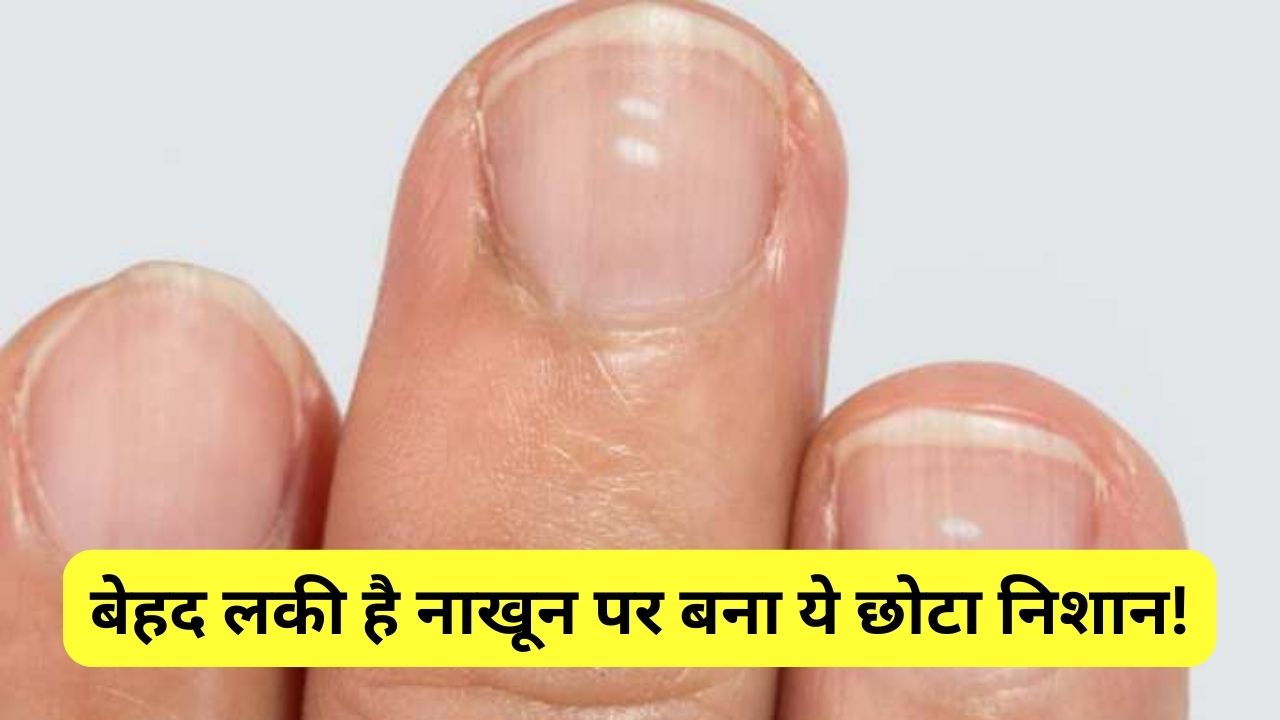 White mark on nails is auspicious or inauspicious know what Vastu