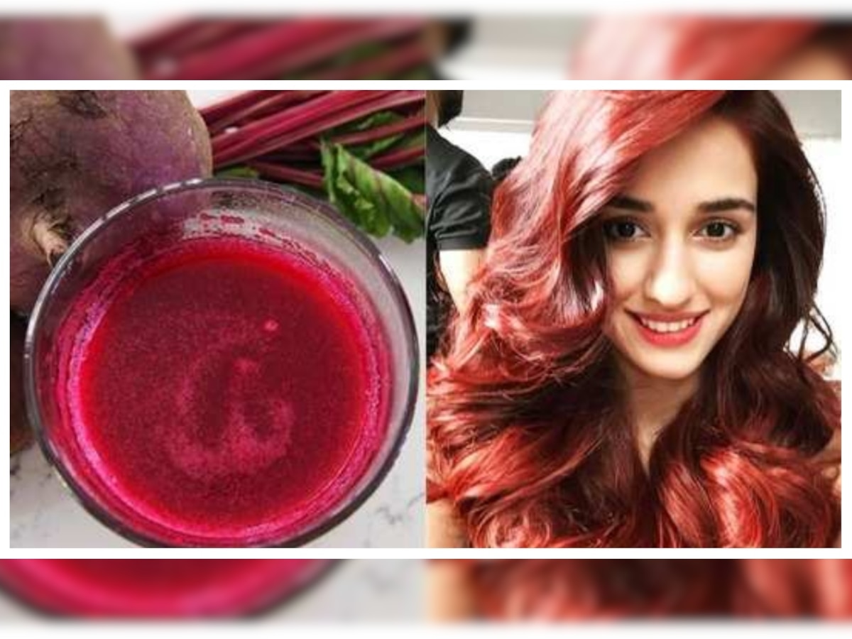 Hair Care Tips: डैंड्रफ का सफाया करेगा चुकंदर, इस तरह से करें इस्तेमाल