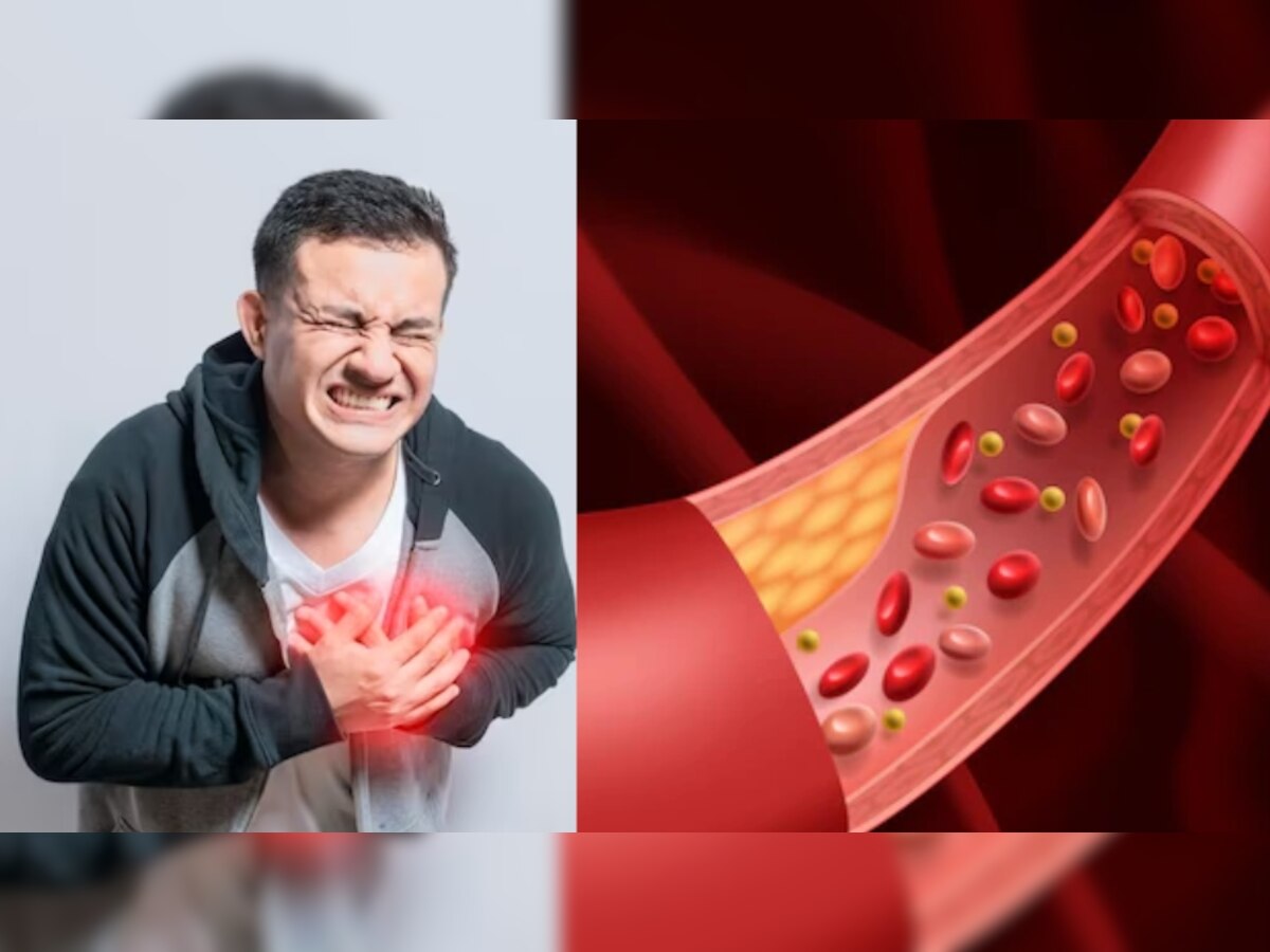 Cholesterol: नसों में जमा कोलेस्ट्रॉल को पिघला देंगे ये जूस, Heart Attack से बचना चाहते हैं तो पीना कर दें शुरू