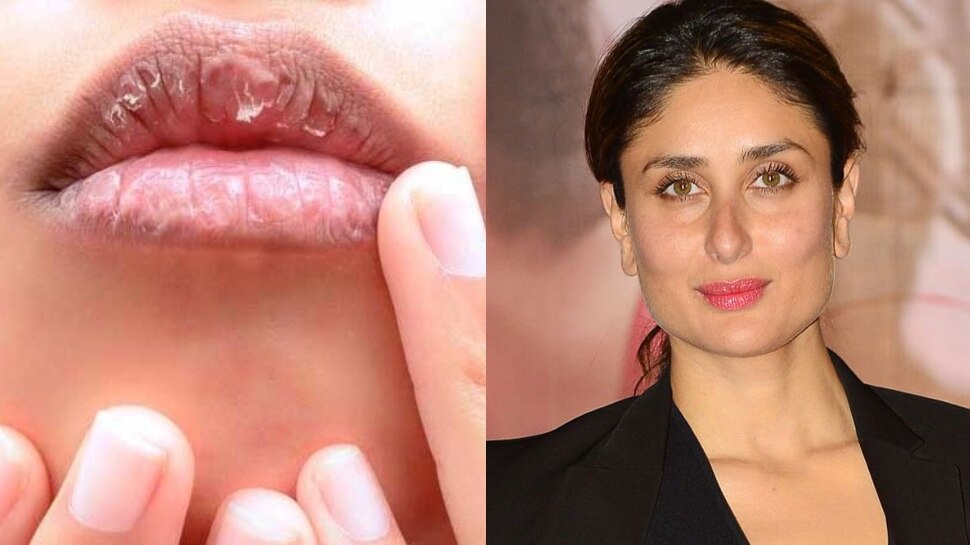 Home Remedies to get rid of chapped lips and get Kareena Kapoor like soft lips Hindi News