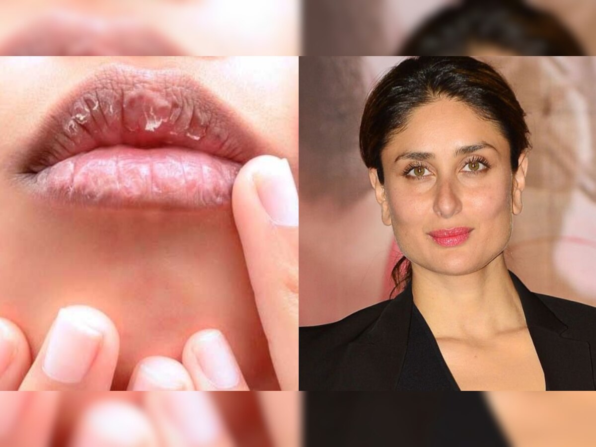 How To Get Rid Of Chapped Lips: सर्दियों में फटे होंठों पर लगाएं ये चीजें, हो जाएंगे Kareena Kapoor जैसे मक्खन मुलायम