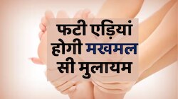Beauty tips : फटी एड़ियां होगी मखमल सी मुलायम ,इस्तेमाल करें ये सफेद चीज