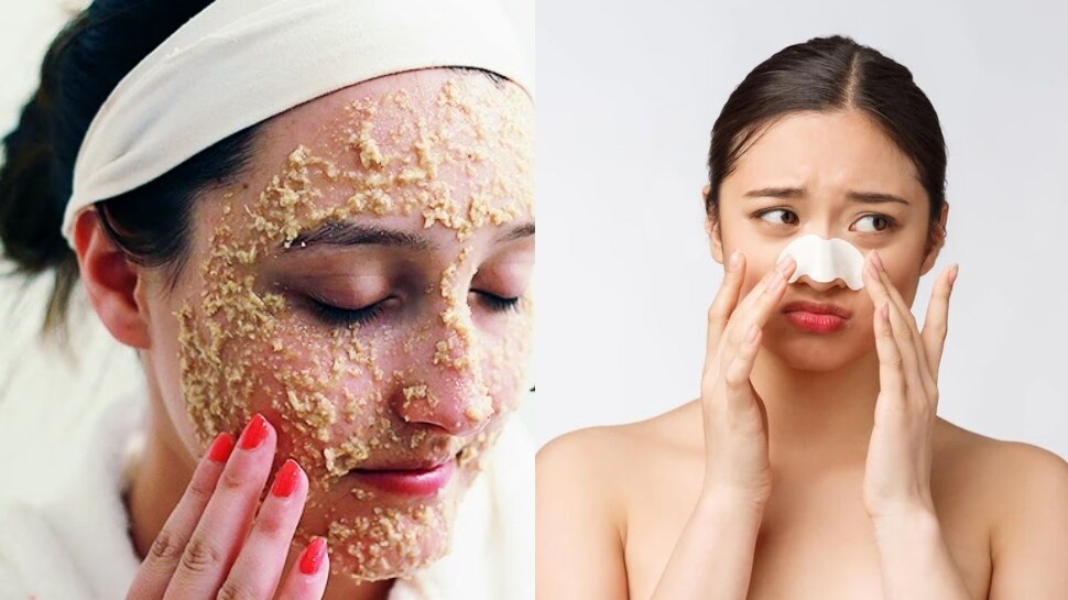 How To Get Rid Of White Heads: ओट्स से दूर भगाएं चेहरे जिद्दी व्हाइटहेड्स, बस इस प्रकार से करें उपयोग