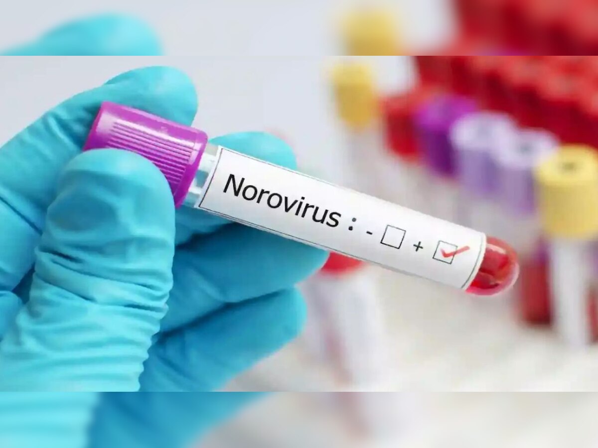 Norovirus Symptoms: କାଳ ହେଲାଣି ନୋରୋ ଭାଇରସ, ଆପଣଙ୍କ ଶିଶୁ ଠାରେ ଦେଖାଯାଉନି ତ ଏ ସବୁ ଲକ୍ଷଣ !