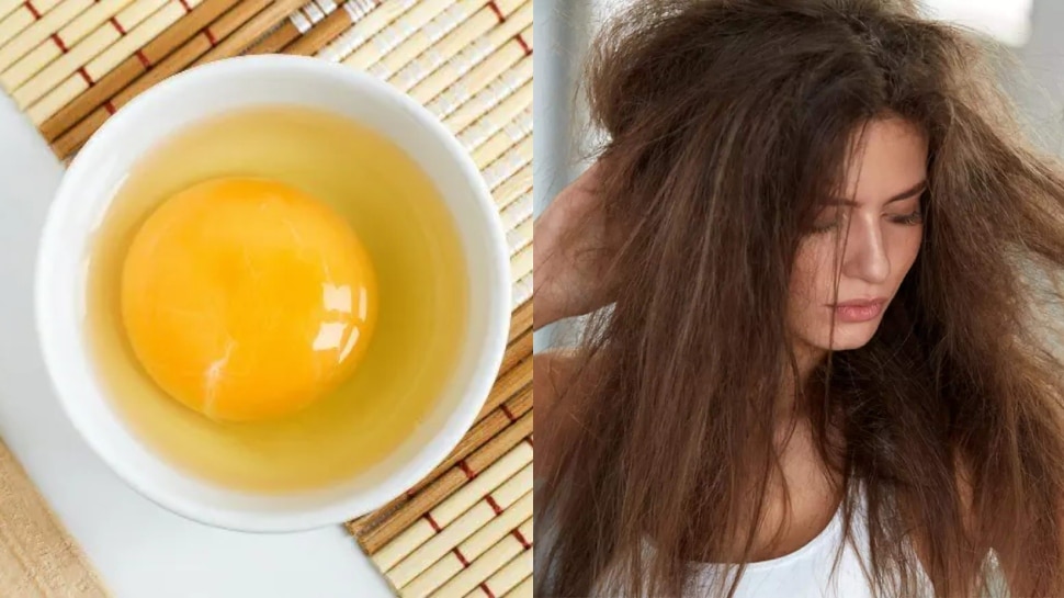 frizzy hair solution at home use egg home remedies hair care | Hindi News, फ्रिजी हेयर से बेहतर डील करता है अंडा, इस तरह से इस्तेमाल करके दूर होगी समस्या frizzy hair solution at home use egg home remedies hair care | Hindi News, फ्रिजी हेयर से बेहतर डील करता है अंडा, इस तरह से इस्तेमाल करके दूर होगी समस्या