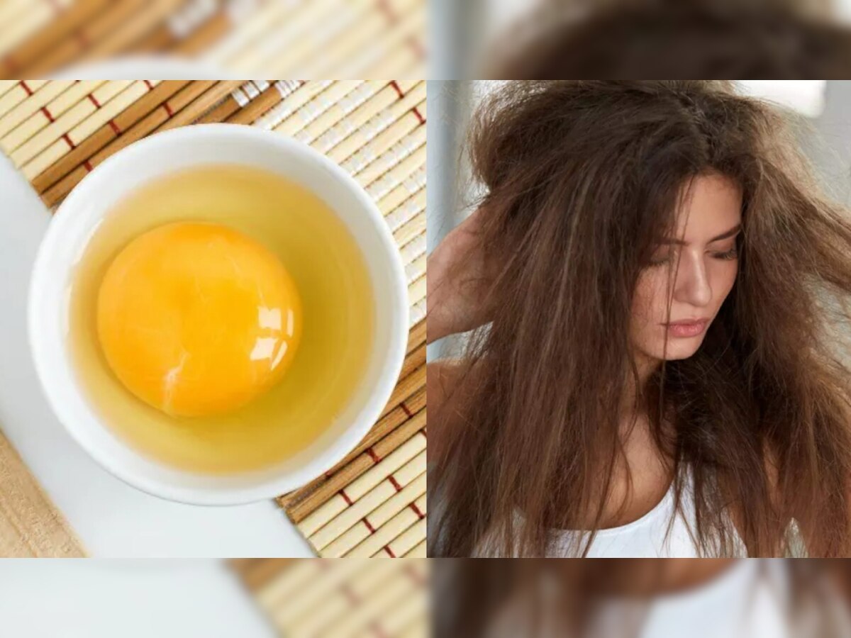 How To Get Rid Of Frizzy Hair: फ्रिजी हेयर से बेहतर डील करता है अंडा, इस तरह से इस्तेमाल करके दूर होगी समस्या