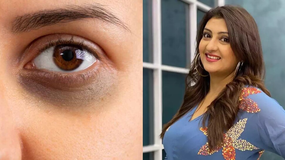 Ways to Get Rid of Dark Circles and Bags Under Eyes Juhi Parmar Home Remedies Hindi News, Juhi