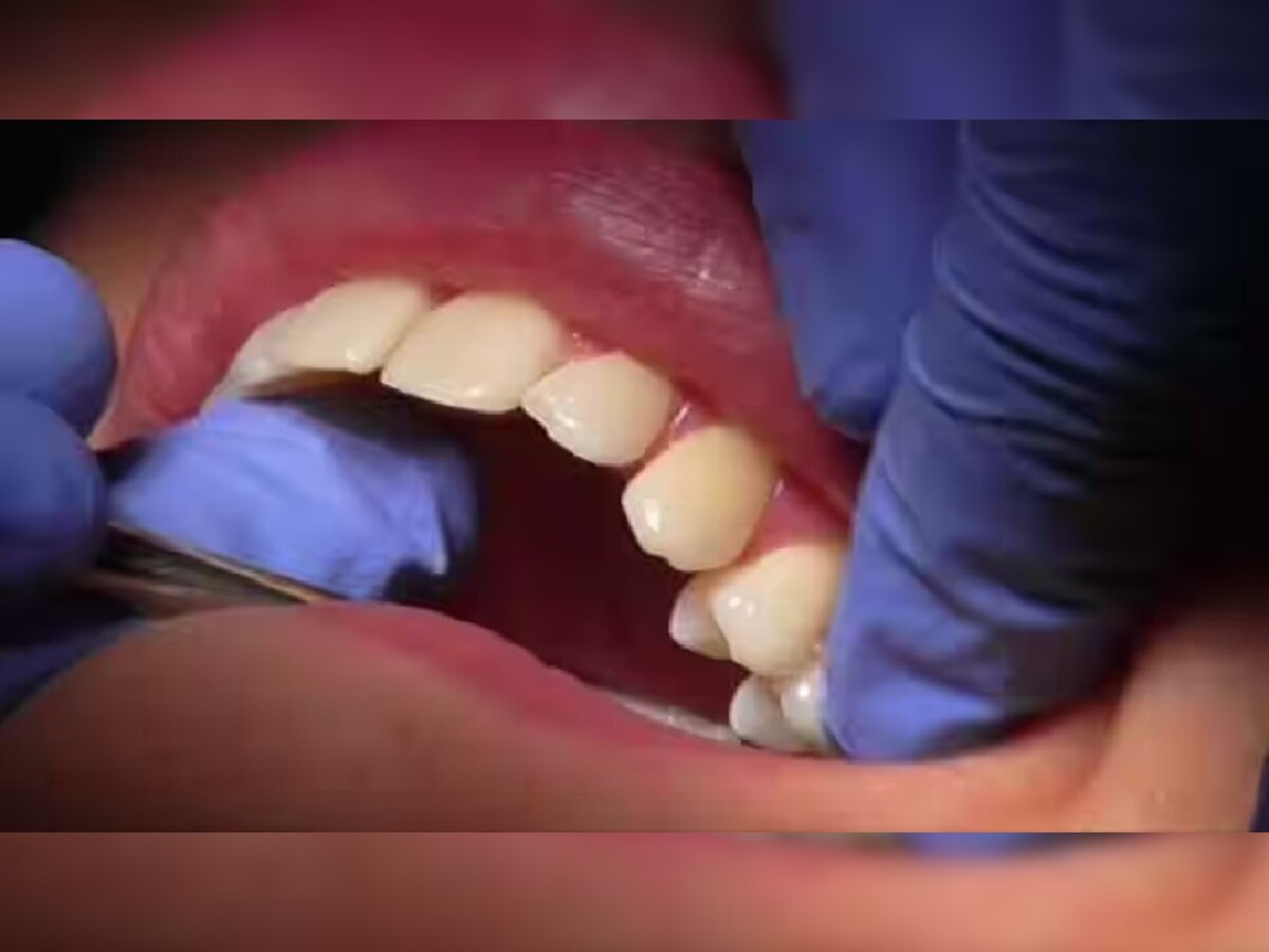 Dental Problem: दांतों के दर्द को न लें हल्‍के में, शरीर में गंभीर बीमारियों के संकेत हो सकते हैं ये लक्षण 