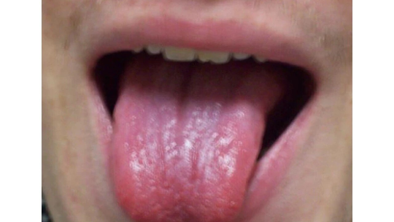 Tongue colour Palmistry: आपकी जीभ का रंग और बनावट बताती है छुपी खूबियां, जान सकते हैं करियर और कारोबर का भविष्य
