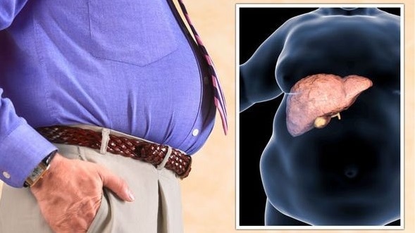 Fatty Liver Disease: कैसे पता करें कि आपको फैटी लिवर डिजीज है? संकेत मिलते ही सतर्क हो जाएं