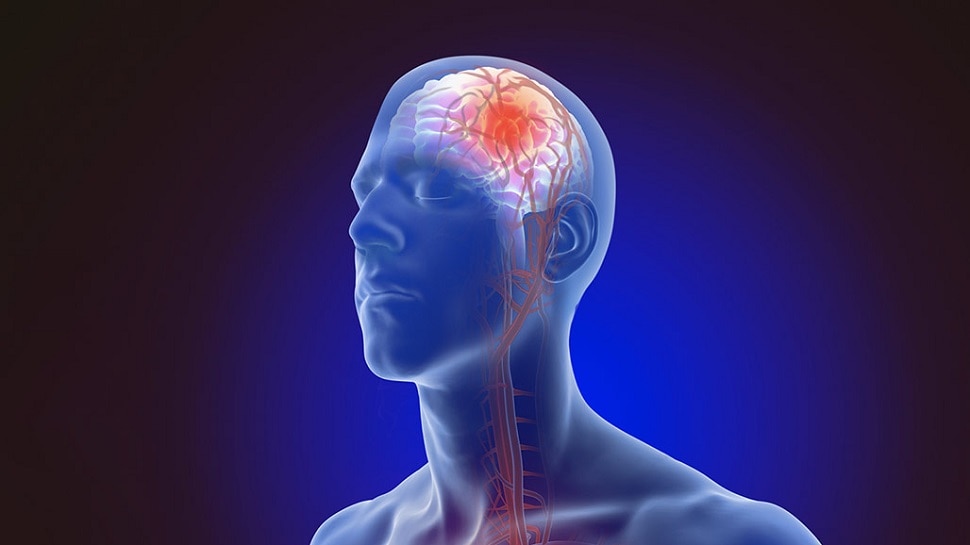 Brain Stroke Symptoms: स्ट्रोक पड़ने से कुछ दिन पहले मिलते हैं ये चेतावनी संकेत, भूलकर भी ना करें इन्हें इग्नोर
