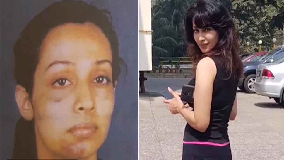 बिगाड़ा चेहरा, प्राइवेट पार्ट्स को भी पहुंचाया नुकसान; 14 महीनों तक जालिम प्रेमी के कैद में रही ये एक्ट्रेस