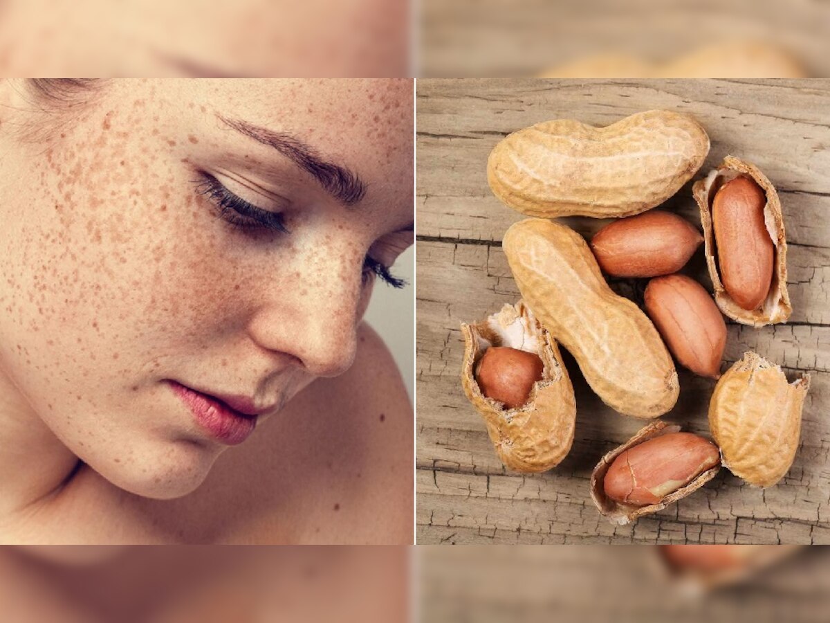 Peanuts Benefits For Skin: स्किन के लिए बेहद फायदेमंद होती है मूंगफली, इन 3 समस्याओं से मिल जाता है छुटकारा