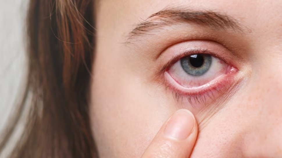 Dry Eyes: मौसम के बदलने से सूखने लगेंगी आंखें, ड्राई आईज से बचने के लिए ऐसे करें देखभाल 