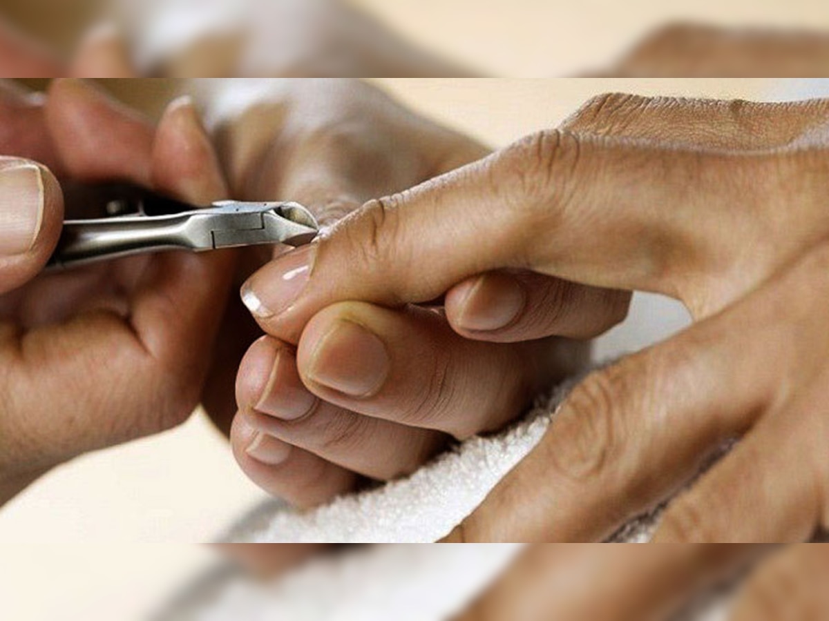 Cuticles Problem on Finger How Do I Stop The Skin Around My Nails From Peeling Easy Home