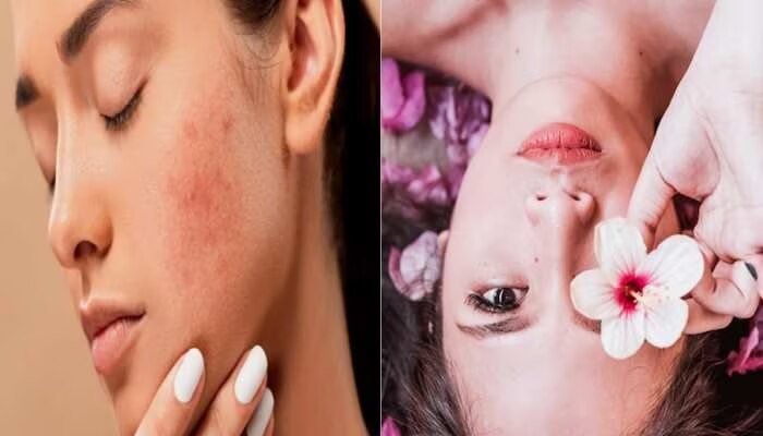 Skin Care Health: गोरे होने की चाहत किडनी को कर रही डैमेज, वक्त रहते हो जाएं सावधान!