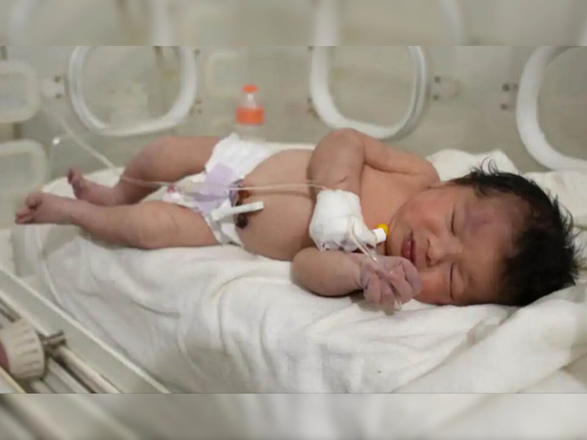 Syria: मलबे में जिंदा मिली मां की गर्भनाल से जुड़ी बच्ची, नीला पड़ गया शरीर, पूरा परिवार खत्म