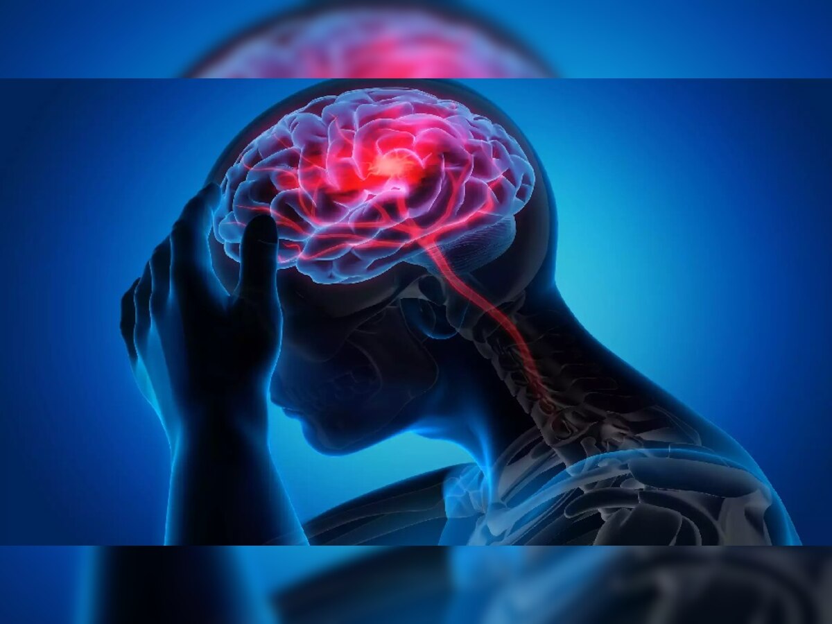 Stroke symptoms: अचानक सोचने या बोलने में होने लगे दिक्कत तो समझ जाएं पड़ने वाला है स्ट्रोक! जानें कैसे करें बचाव