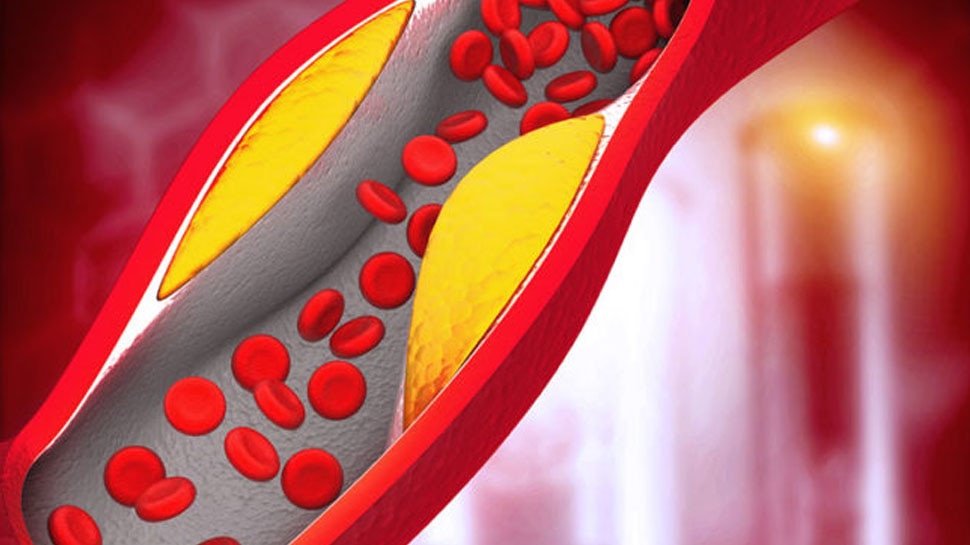 High Cholesterol: बढ़ते कोलेस्ट्रॉल ने कर रखा है परेशान? अपना लें ये 5 आयुर्वेदिक उपाय, बिना साइड इफेक्ट्स के तुरंत होगा फायदा 