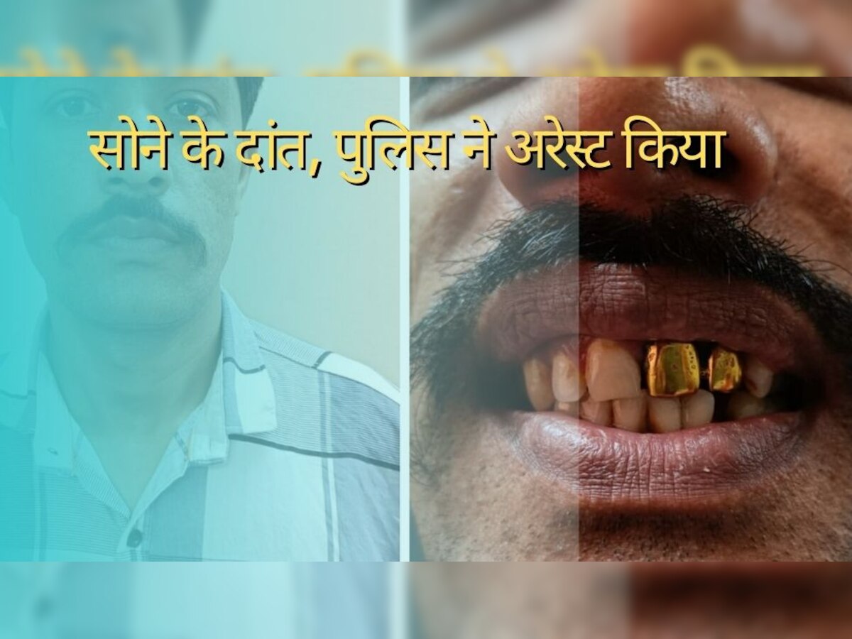 Golden Teeth: 15 साल से फरार था शख्स..मुंह में सोने के दांत निकले! पुलिस ने किया अरेस्ट