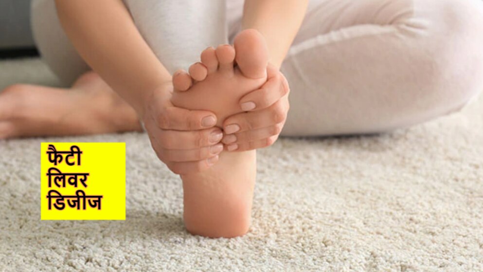 symptoms of fatty liver appears in feet swelling and pain itching अगर
