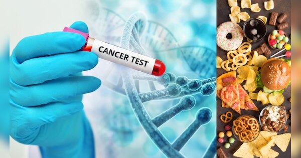 Cancer Causing Foods Ultra Processed Fast Food Alcohol These 3 Things ...