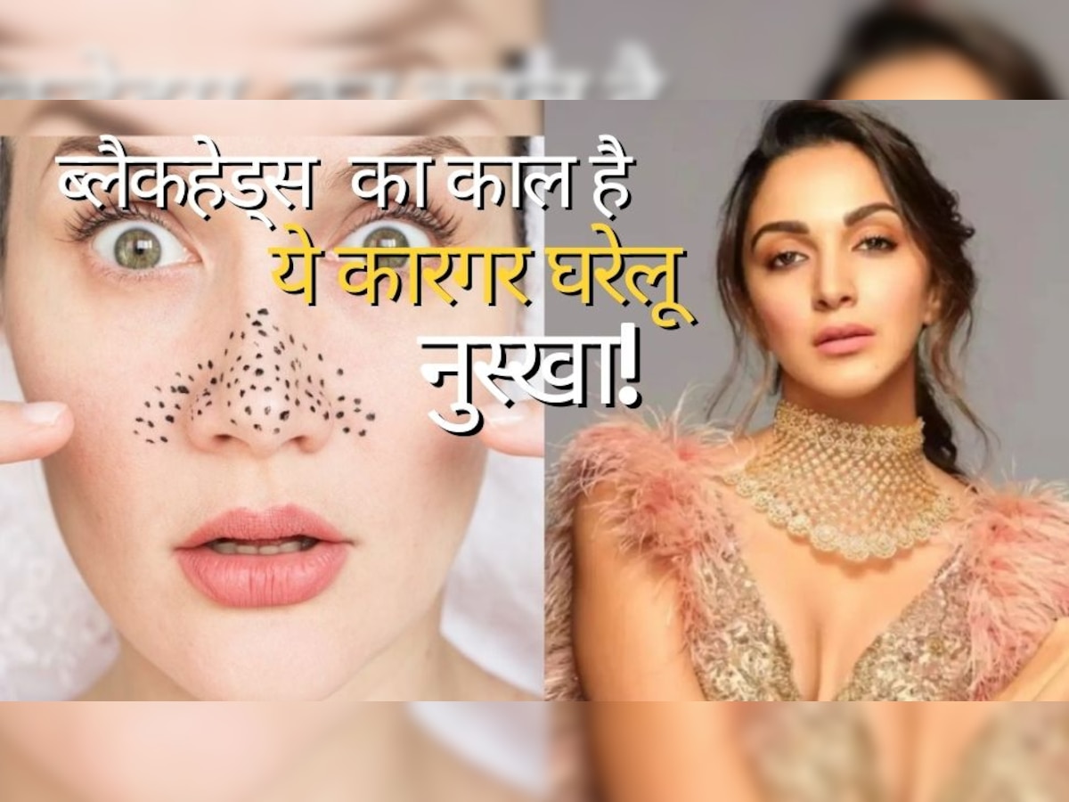 Blackheads Solution: नाक से जिद्दी Blackheads को दूर कर देगा ये उपाय, Kiara Advani जैसी चमक उठेगी स्किन