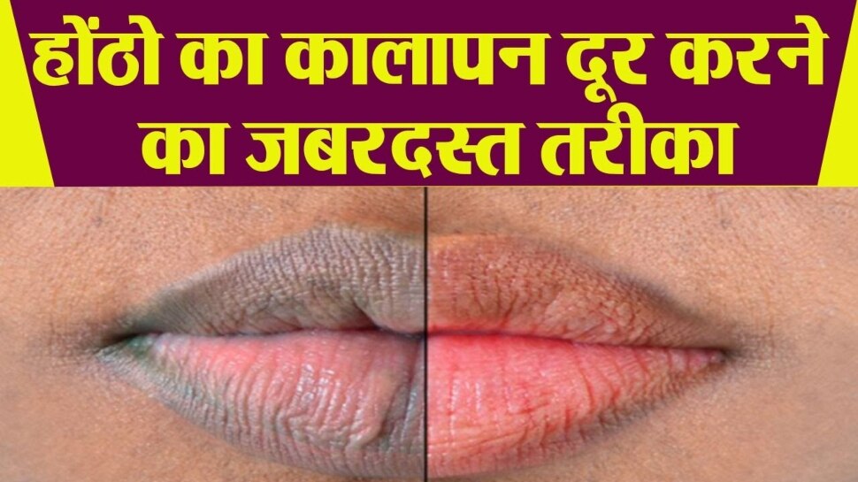 How To Remove Upper Lip Darkness Use Besan Lip Lightening Mask Lip Care