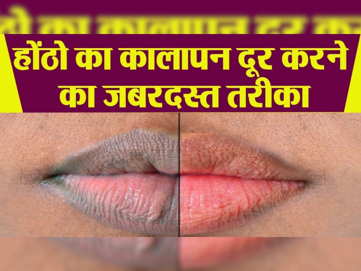 Upper Lip के कालेपन को दूर कर देगी किचन की ये चीज, निखर जाएगी होंठों की रंगत