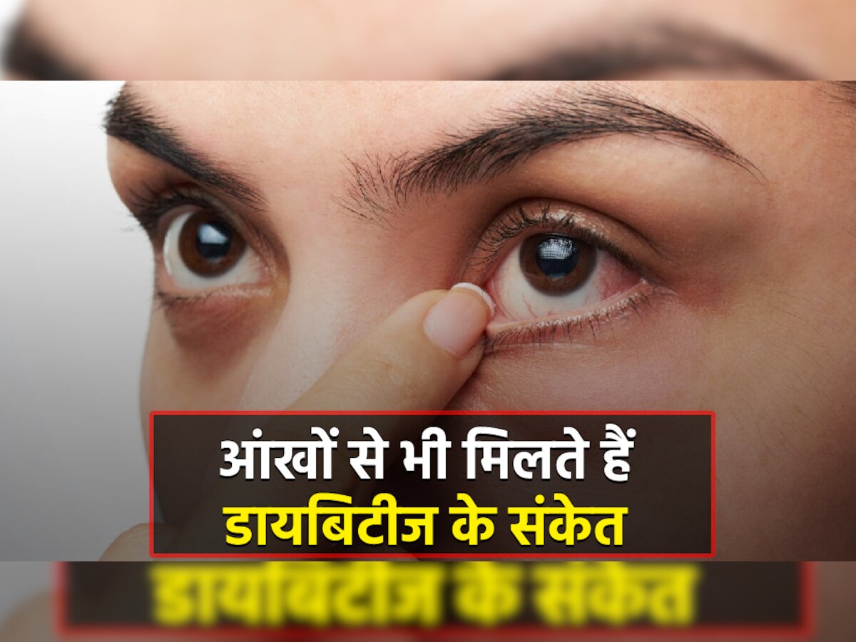 Diabetes Symptoms: आंखों से भी मिलते हैं डायबिटीज के संकेत, इन लक्षणों को भूलकर भी ना करें नजरअंदाज