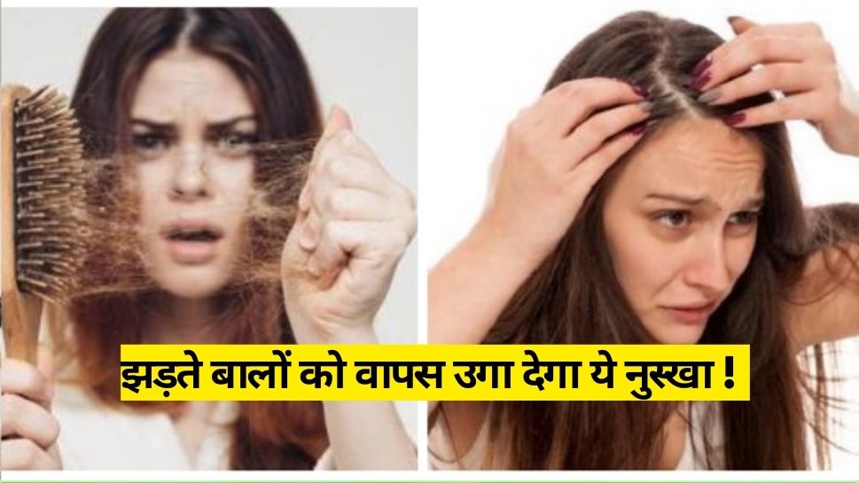 Aggregate 87+ hair fall control in hindi best in.eteachers